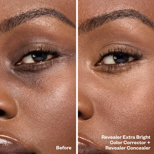 Before and After Bright Eyes Set